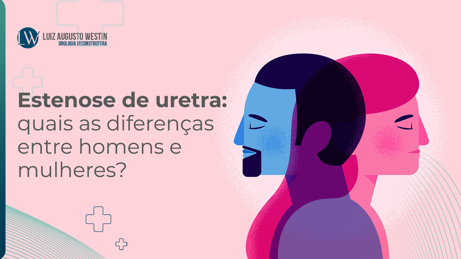Estenose de uretra: quais as diferenças entre homens e mulheres?