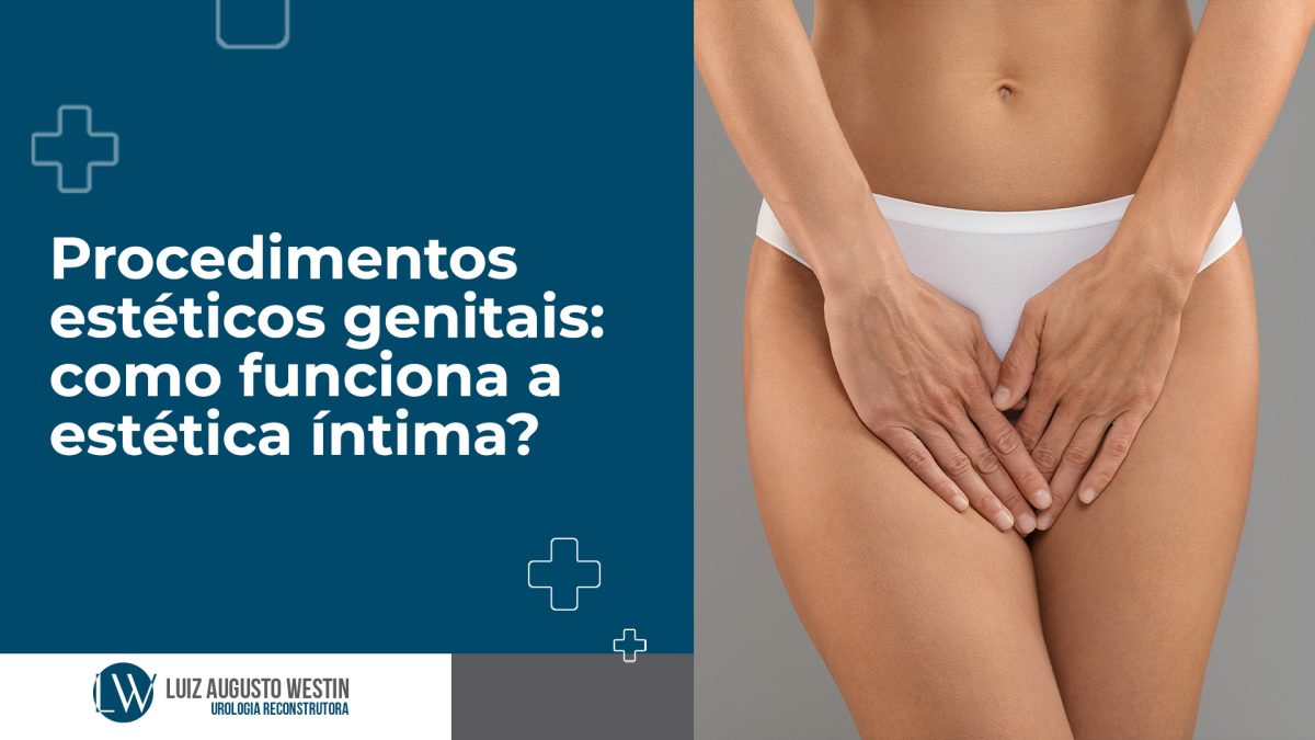 Procedimentos estéticos genitais: como funciona a estética íntima?