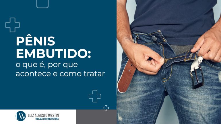 Pênis embutido: o que é, por que acontece e como tratar